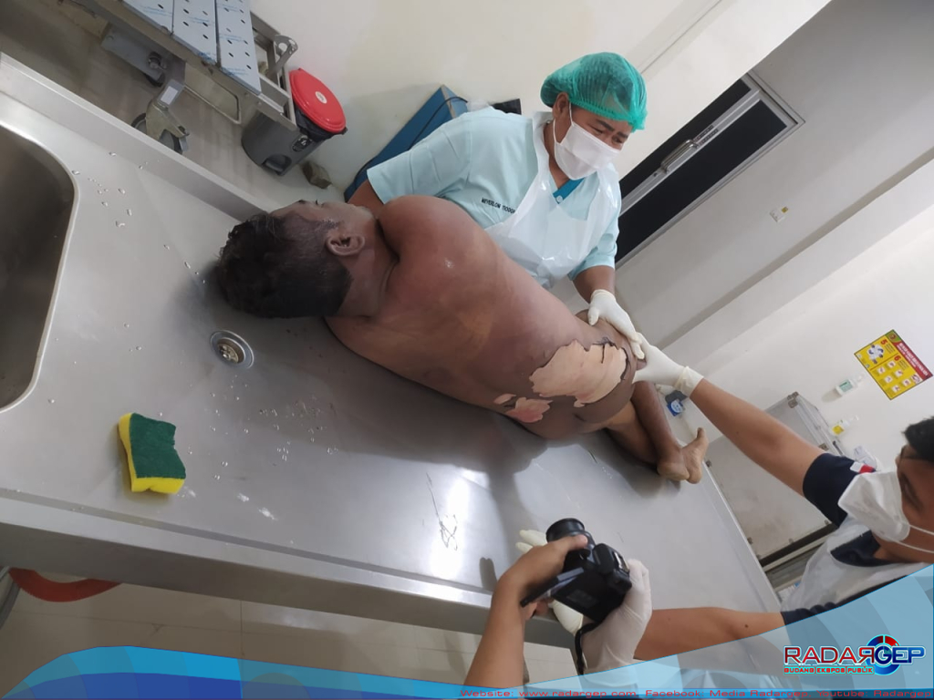 Pria Warga Desa Sarang Ginting Kahan Sergai Tewas Disambar Petir di Ladang Sawit