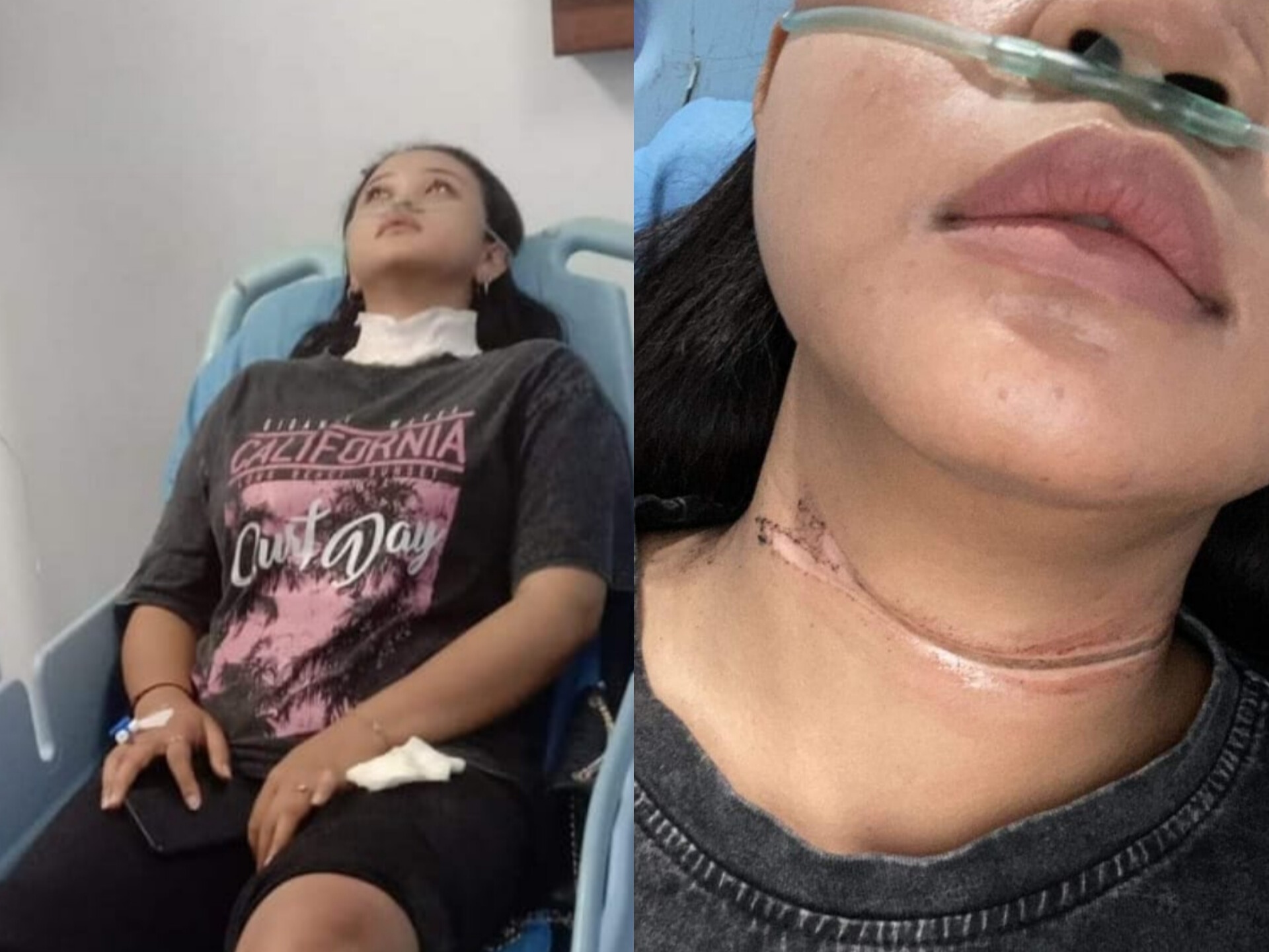 Warga Delima Nyaris Tewas Akibat Kabel Wifi Sembraut di Pekanbaru